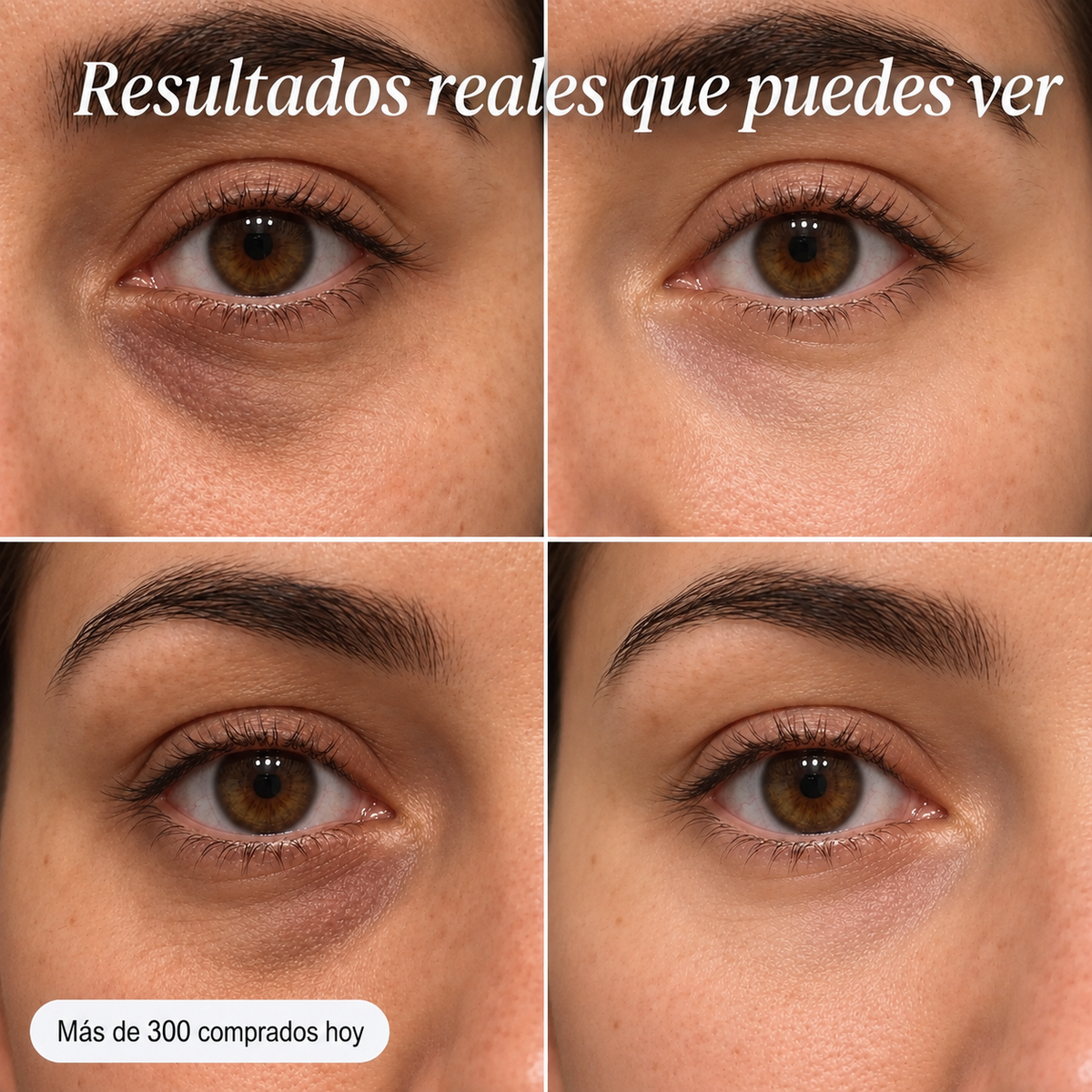 Bálsamo PDRN Colágeno — 3